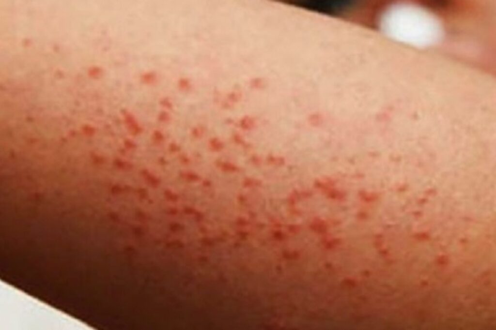 WhatsApp Image 2025-11-04 at 10.33.56