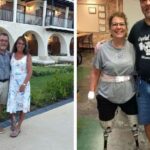 Mujer pierde brazos y piernas tras infección causada por su perro: “fue el peor día de mi vida”