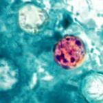 México confirma tres casos de Cyclospora; Salud descarta brote en el país